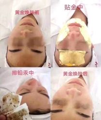 -skin79皮肤管理中心