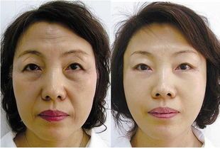 -SKINIST丽铂医疗美容