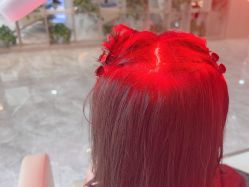 -碧莲盛·不剃发植发