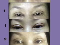 eyes-上海华安整形外科门诊部