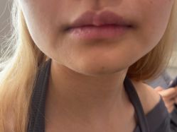 点击看大图 -BR光电保养