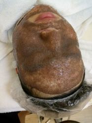 -苗方清颜祛痘·皮肤管理