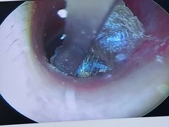 -溥耳·可视采耳·头疗·沐眼