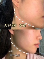 -上海伊莱美医疗美容医院