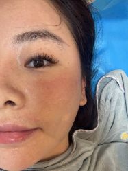 -深圳鹏爱秀琪医疗美容医院