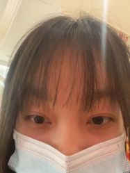 -广州健丽·去眼袋医疗美容机构