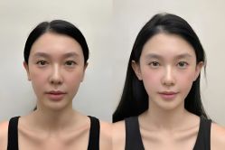 -上海伊莱美医疗美容医院