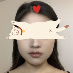 体验前-杭州海亮医院 · 禾芸嘉医美中心