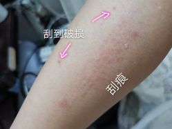 体验后-广东韩妃整形外科医院
