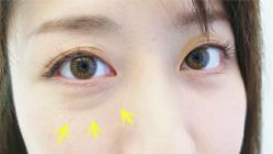 -SKINIST丽铂医疗美容