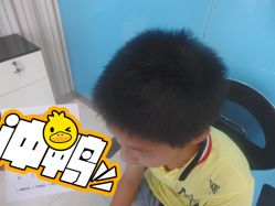 点击看大图 -碧莲盛·不剃发植发