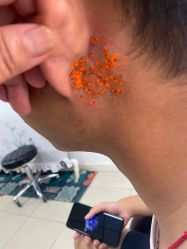-百年美肤堂祛痦痣祛斑祛疣