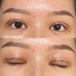 点击看大图 体验后-海峡医疗美容医院