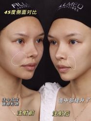 -上海玫瑰医疗美容医院