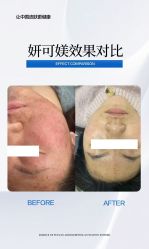 -SOS修丽可.痘肌修复中心