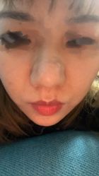 -北京丽星翼美医疗美容