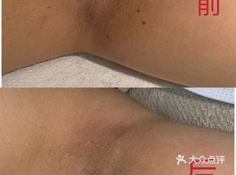 夏天都到了 还不赶紧……