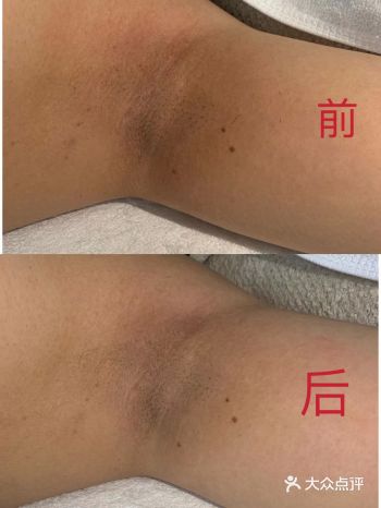 夏天都到了 还不赶紧……