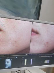 -苑苑vbeauty科技美容SPA