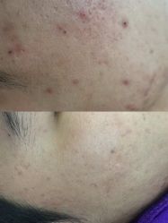 -蕾特恩专业祛痘·皮肤管理