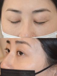 -清疣美疣·痣·斑净肤中心