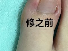 -郑远元专业修脚房·按摩·肉刺·灰指甲(东安路店)