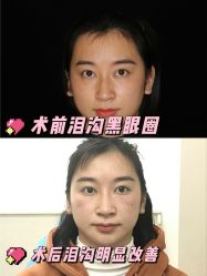 -广东韩妃整形外科医院