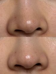 -美愈美肤MEIYU SKIN