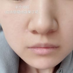 体验后-北京米扬丽格医疗美容·联合丽格鼻整形中心