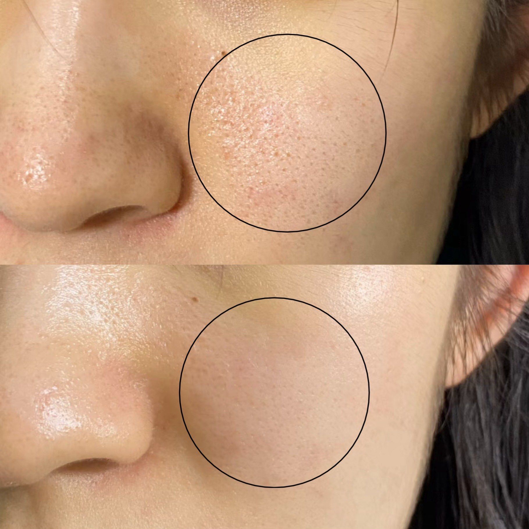 新一代海菲秀 
这个平滑角质的效果