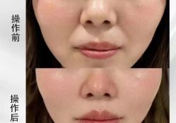 -郡艺医疗美容·微整·眼鼻吸脂