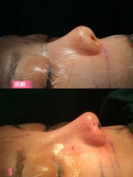 -北京米扬丽格医疗美容·联合丽格鼻整形中心