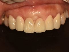 -精德口腔·种植修复·儿牙中心(财富中心店)