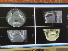 -土豆口腔(凤凰北总店)