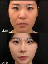 -北京米扬丽格医疗美容·联合丽格鼻整形中心