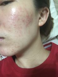 -兰汇祛痘瘦身连锁机构