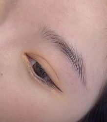 体验后-素妍医疗美容抗衰中心