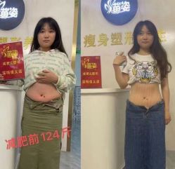 -苗姿减肥护肤