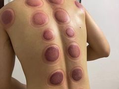 -安琪盲人按摩调理草本熏蒸馆(风和日丽店)