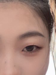 体验前-上海首尔丽格医疗美容医院