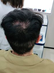 -雍禾植发全国连锁