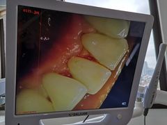 -Dr.Z dental仁康种植矫正中心