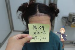 -大麦微针植发丨全国连锁