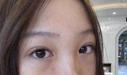 体验后-木锦-科技美肤