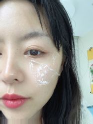 -美丽人生祛斑扁平疣汗管瘤中心
