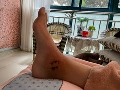 -成都市第一人民医院(南区)