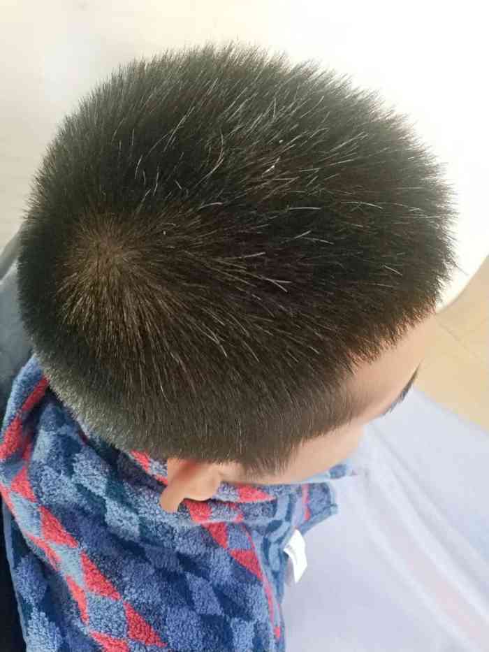 黑茸老姜王脱发生发 白发转黑