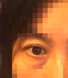 -八大处整形