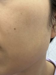 体验前-深圳医恒美医疗美容
