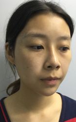 -南京健丽·去眼袋医疗美容机构